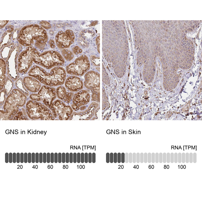 GNS Antibody in Immunohistochemistry (Paraffin) (IHC (P))