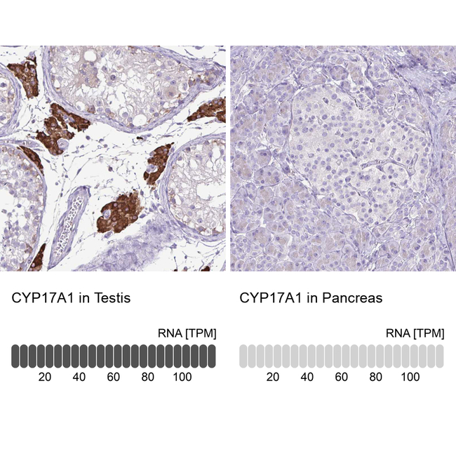 CYP17A1 Antibody in Immunohistochemistry (Paraffin) (IHC (P))