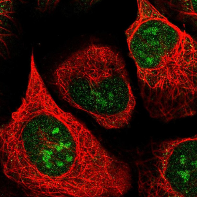 Apoptosis-Enhancing Nuclease Antibody in Immunocytochemistry (ICC/IF)