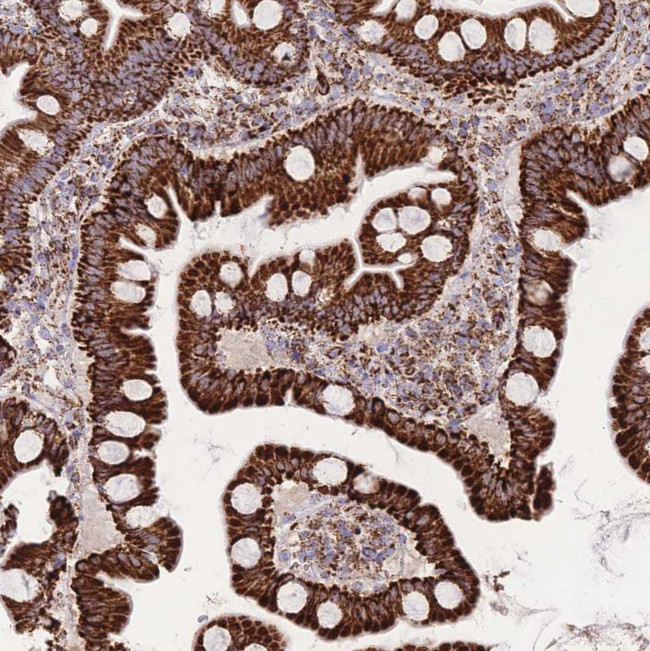 GSTM1 Antibody in Immunohistochemistry (Paraffin) (IHC (P))