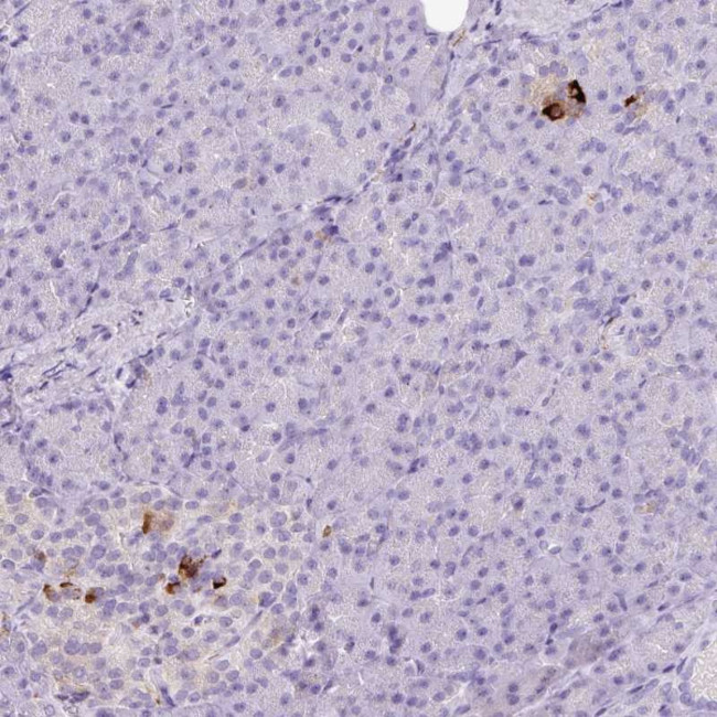 Kir6.2 (KCNJ11) Antibody in Immunohistochemistry (Paraffin) (IHC (P))