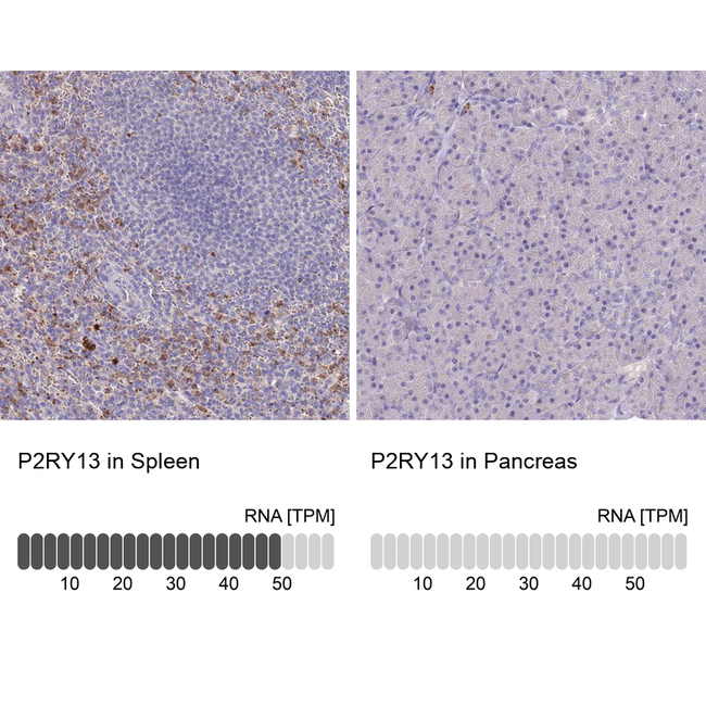 P2Y13 Antibody in Immunohistochemistry (Paraffin) (IHC (P))