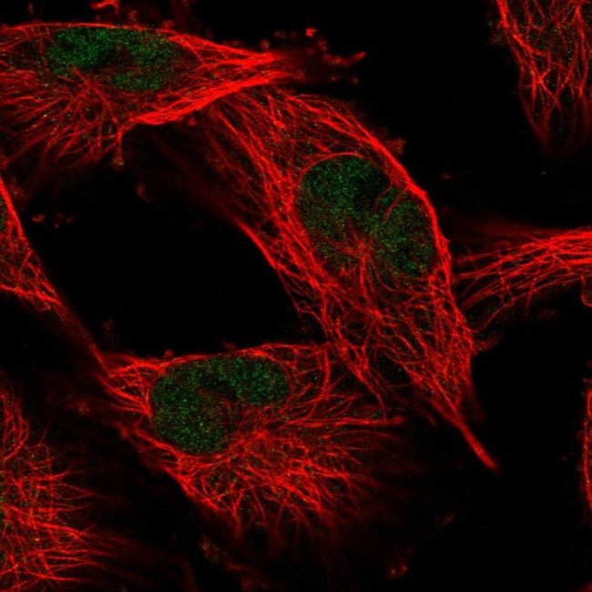 COMMD1 Antibody in Immunocytochemistry (ICC/IF)