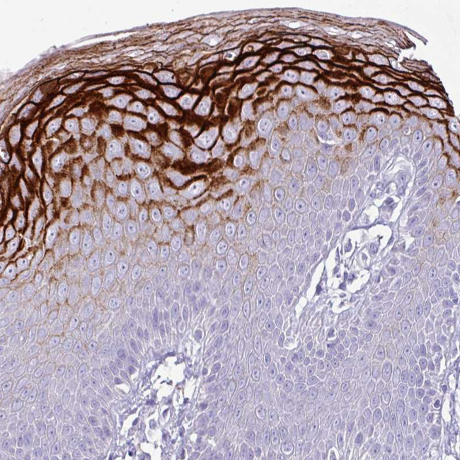 GLP2R Antibody in Immunohistochemistry (Paraffin) (IHC (P))