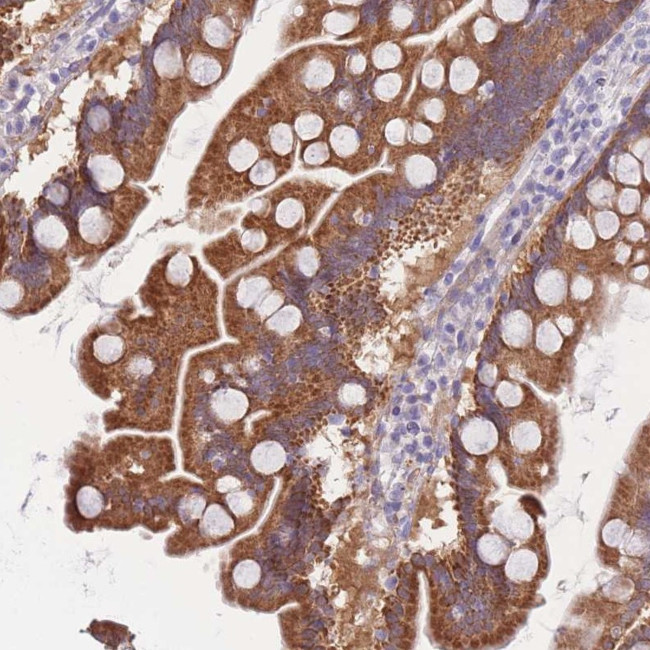SULT1A1 Antibody in Immunohistochemistry (Paraffin) (IHC (P))