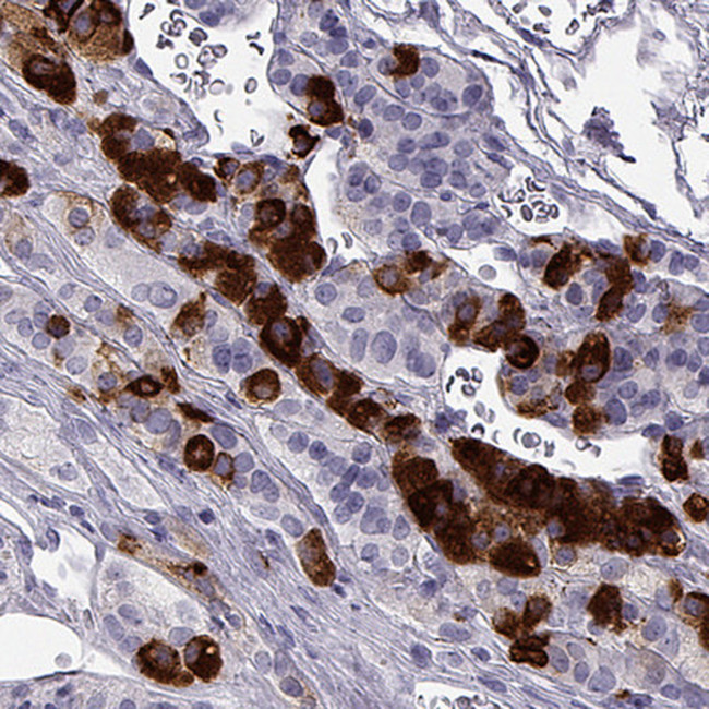 NPTX2 Antibody in Immunohistochemistry (Paraffin) (IHC (P))