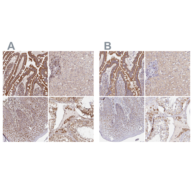 MAVS Antibody in Immunohistochemistry (Paraffin) (IHC (P))