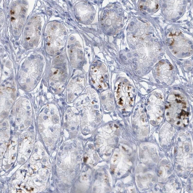 WNT11 Antibody in Immunohistochemistry (Paraffin) (IHC (P))
