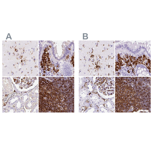 HLA-DRA Antibody in Immunohistochemistry (Paraffin) (IHC (P))