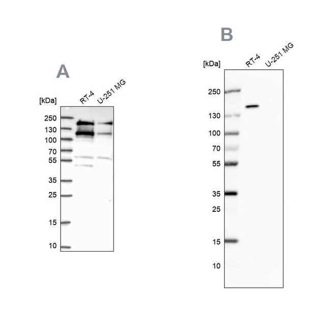 TOP2B Antibody in Western Blot (WB)