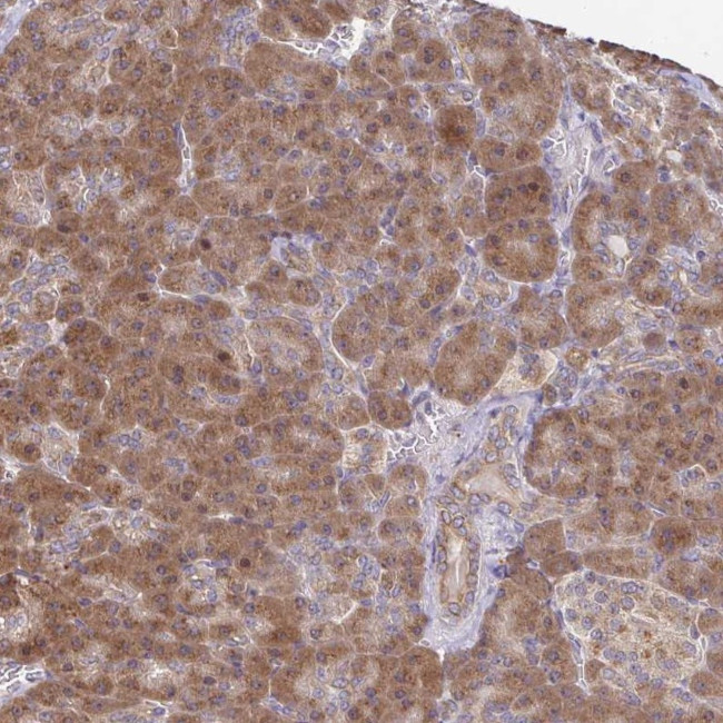 IKAP Antibody in Immunohistochemistry (Paraffin) (IHC (P))