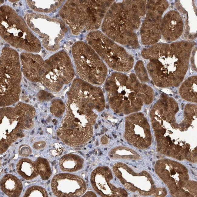 FBXO6 Antibody in Immunohistochemistry (Paraffin) (IHC (P))