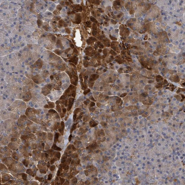 TRPC4AP Antibody in Immunohistochemistry (Paraffin) (IHC (P))