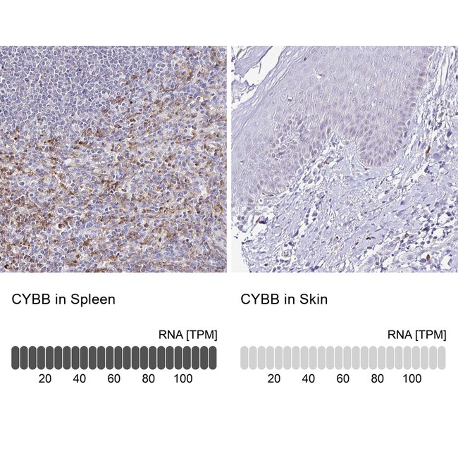 NOX2 Antibody in Immunohistochemistry (Paraffin) (IHC (P))