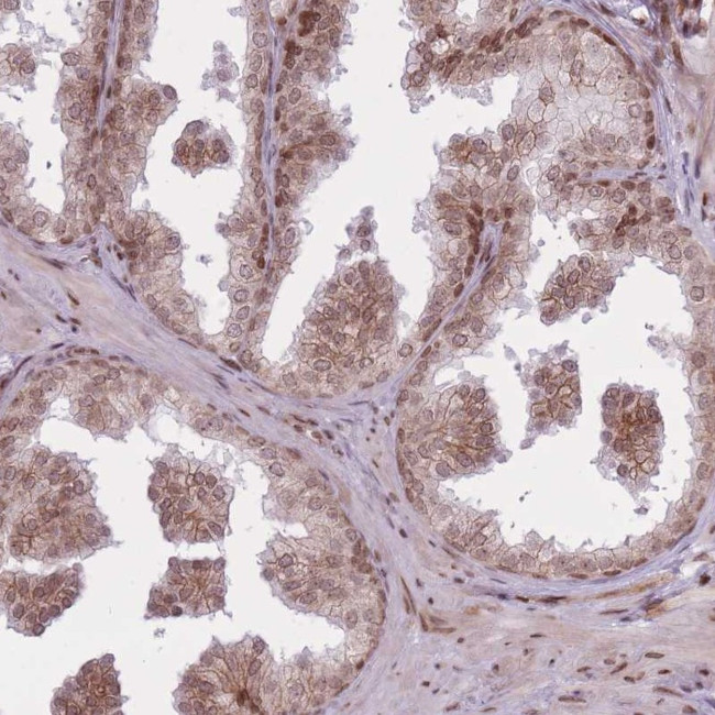 TMC6 Antibody in Immunohistochemistry (Paraffin) (IHC (P))