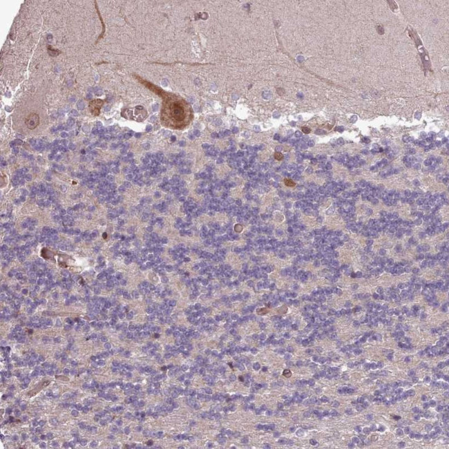 CABP1 Antibody in Immunohistochemistry (Paraffin) (IHC (P))