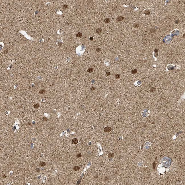 PSMB7 Antibody in Immunohistochemistry (Paraffin) (IHC (P))