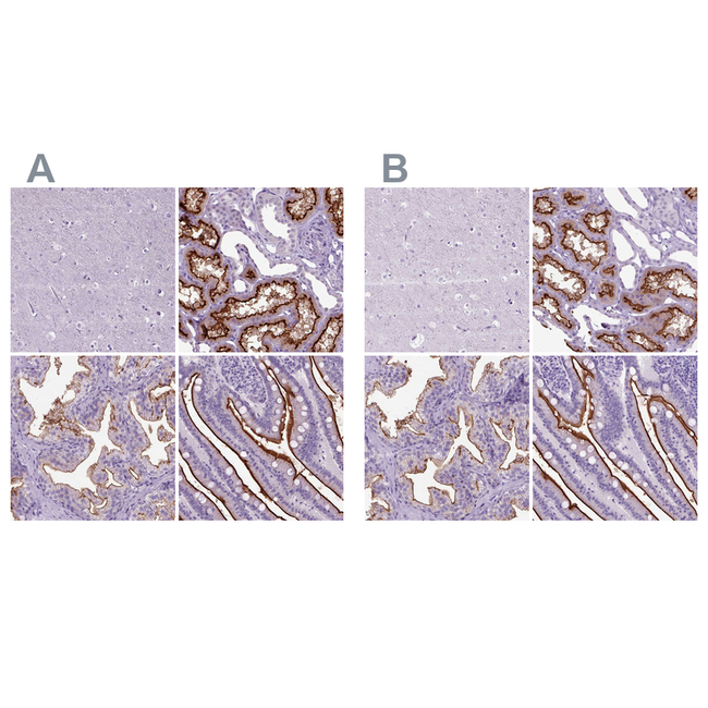 CD10 Antibody in Immunohistochemistry (Paraffin) (IHC (P))