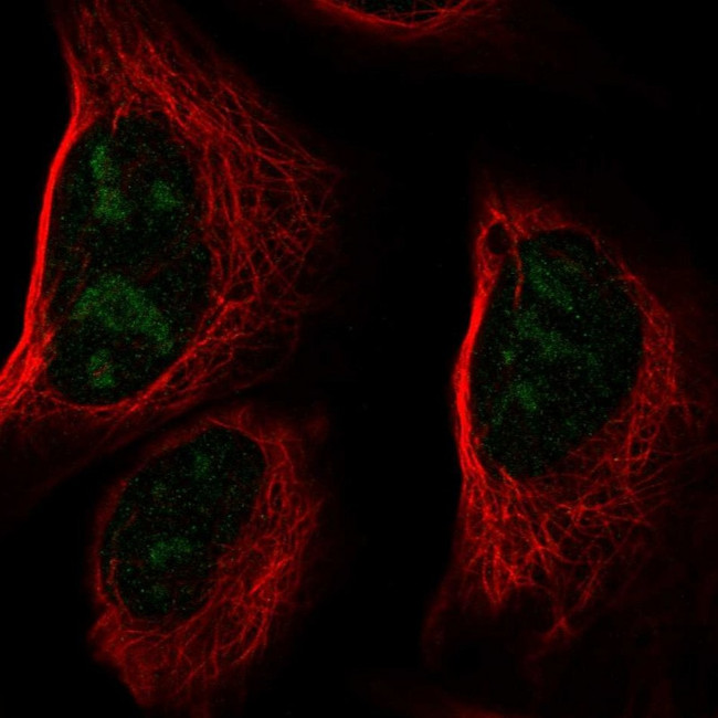CCDC137 Antibody in Immunocytochemistry (ICC/IF)