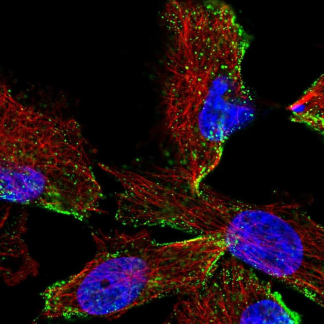 HPS3 Antibody in Immunocytochemistry (ICC/IF)