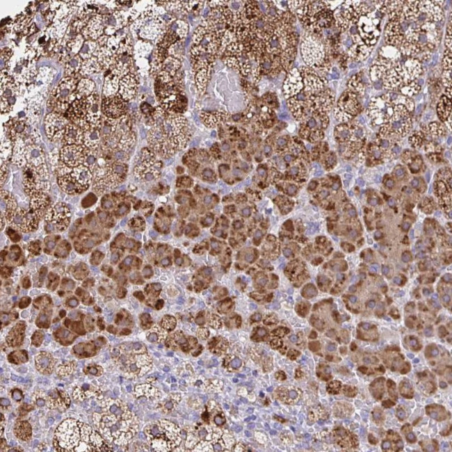 JMJD4 Antibody in Immunohistochemistry (Paraffin) (IHC (P))