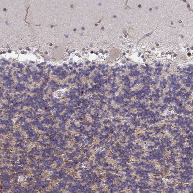 ZIC3 Antibody in Immunohistochemistry (Paraffin) (IHC (P))