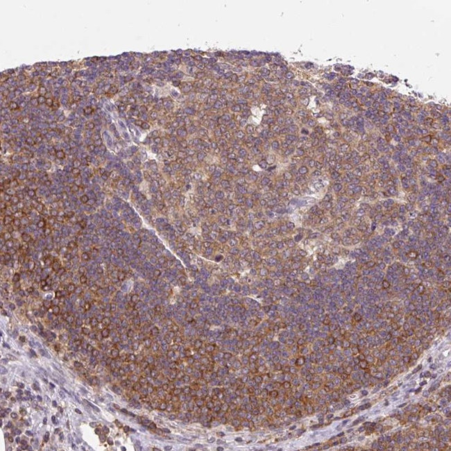 CARD11 Antibody in Immunohistochemistry (Paraffin) (IHC (P))