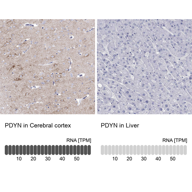 Prodynorphin Antibody in Immunohistochemistry (Paraffin) (IHC (P))