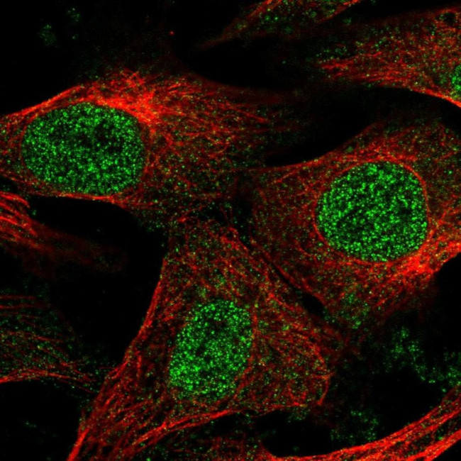 EPM2A Antibody in Immunocytochemistry (ICC/IF)