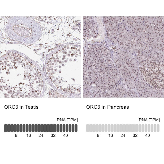 ORC3 Antibody in Immunohistochemistry (Paraffin) (IHC (P))