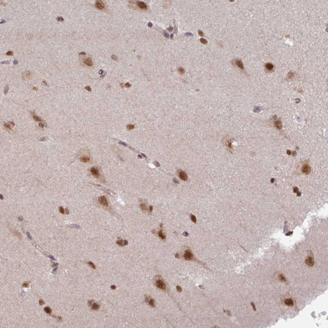 LHX5 Antibody in Immunohistochemistry (Paraffin) (IHC (P))