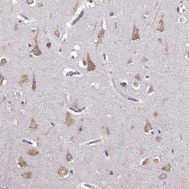 GABRG3 Antibody in Immunohistochemistry (Paraffin) (IHC (P))