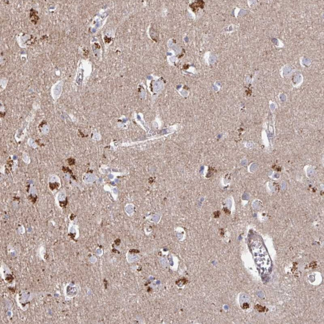 PRR5 Antibody in Immunohistochemistry (Paraffin) (IHC (P))