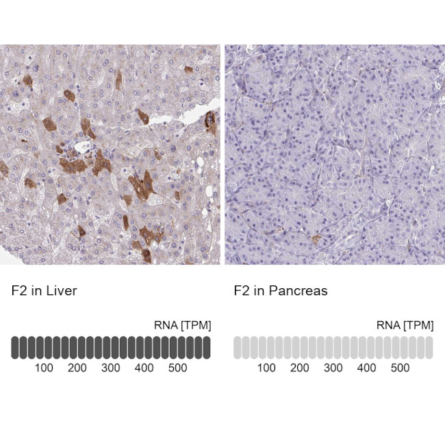 Thrombin Antibody in Immunohistochemistry (Paraffin) (IHC (P))