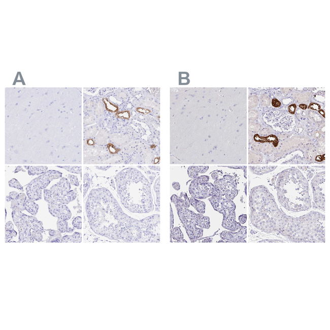 Uromodulin Antibody in Immunohistochemistry (Paraffin) (IHC (P))