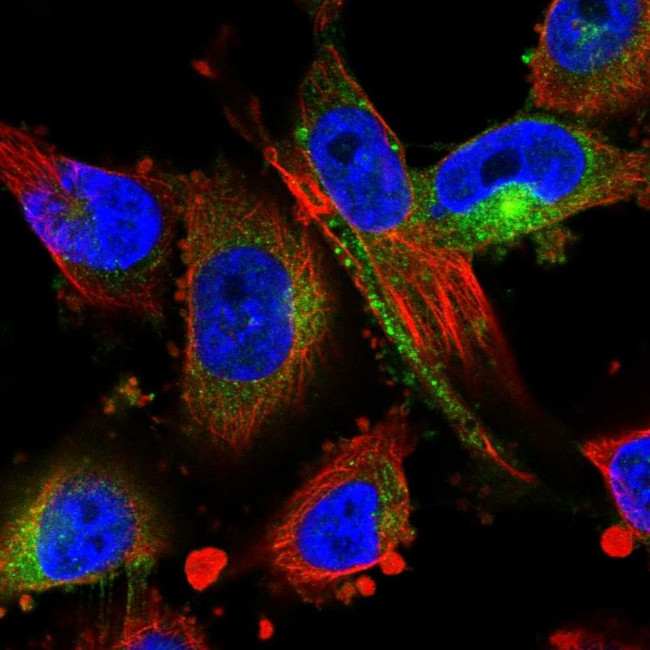 MARCKS Antibody in Immunocytochemistry (ICC/IF)