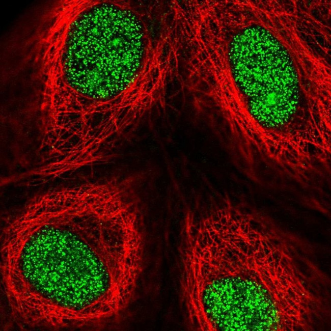 ZFP69 Antibody in Immunocytochemistry (ICC/IF)