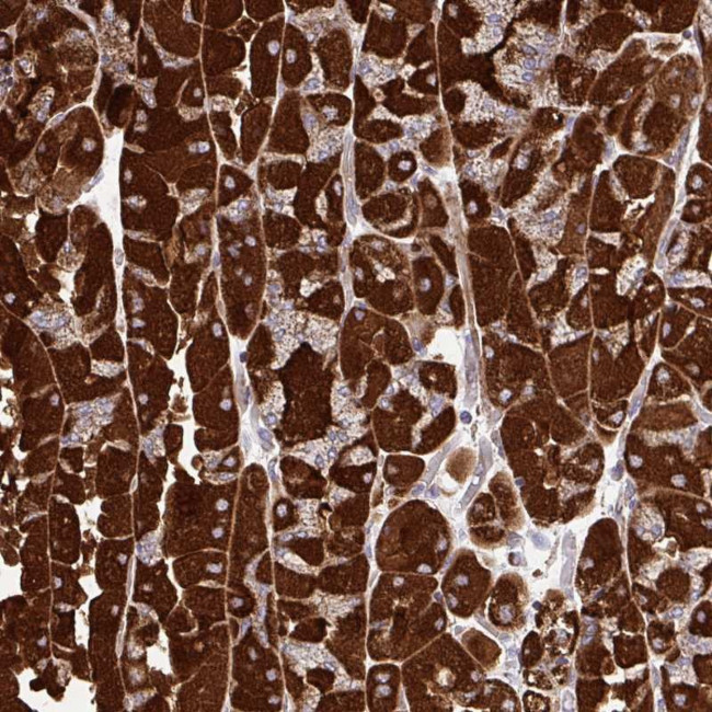 UBE2C Antibody in Immunohistochemistry (Paraffin) (IHC (P))