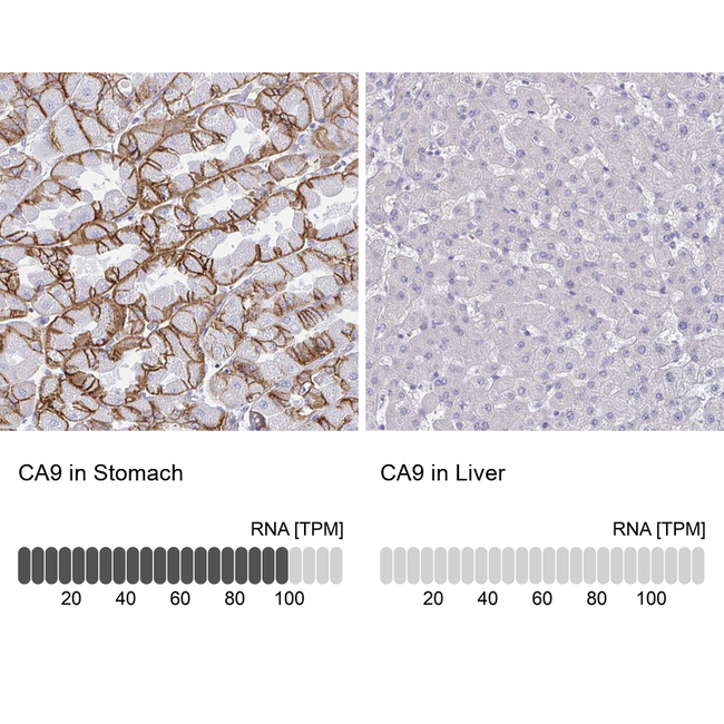 Carbonic Anhydrase IX Antibody in Immunohistochemistry (Paraffin) (IHC (P))