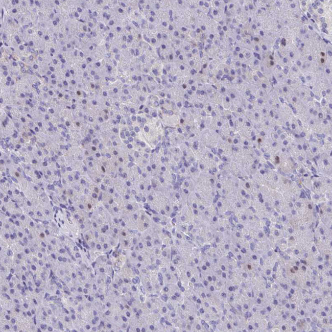 FCGR3A Antibody in Immunohistochemistry (Paraffin) (IHC (P))
