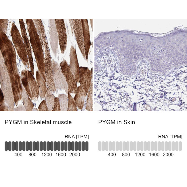 PYGM Antibody in Immunohistochemistry (Paraffin) (IHC (P))