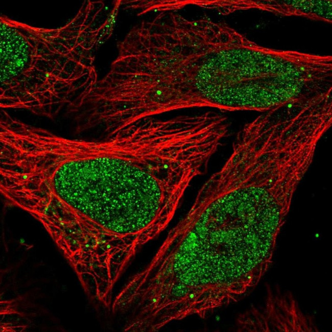 MNAR Antibody in Immunocytochemistry (ICC/IF)