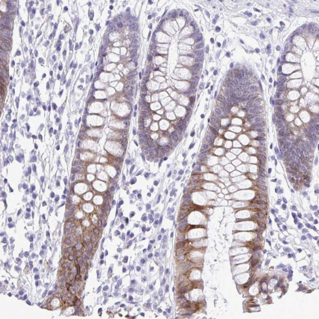 PIGK Antibody in Immunohistochemistry (Paraffin) (IHC (P))