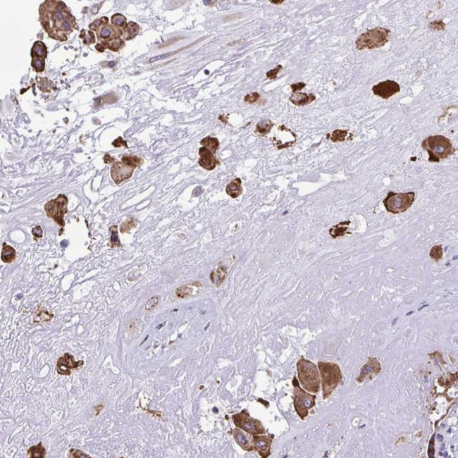 PIGK Antibody in Immunohistochemistry (Paraffin) (IHC (P))