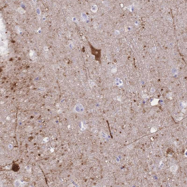 GRB7 Antibody in Immunohistochemistry (Paraffin) (IHC (P))