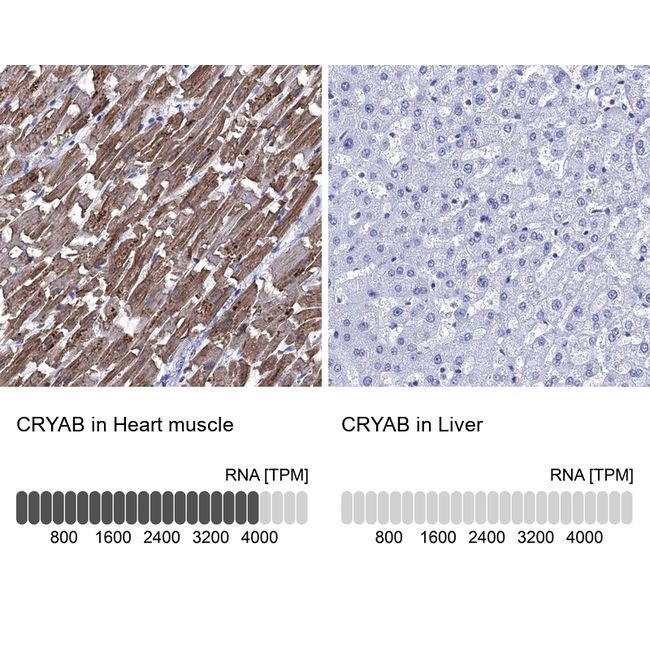 CRYAB Antibody in Immunohistochemistry (Paraffin) (IHC (P))