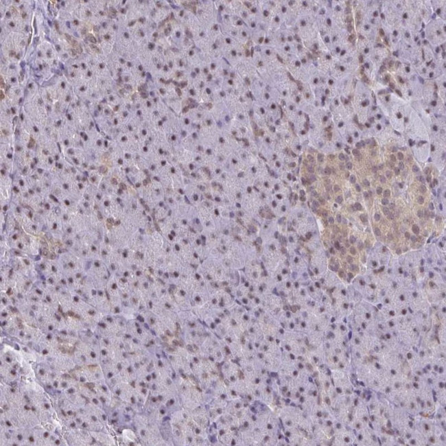 ING4 Antibody in Immunohistochemistry (Paraffin) (IHC (P))
