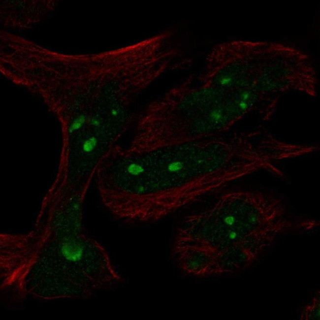 n-Myc Antibody in Immunocytochemistry (ICC/IF)