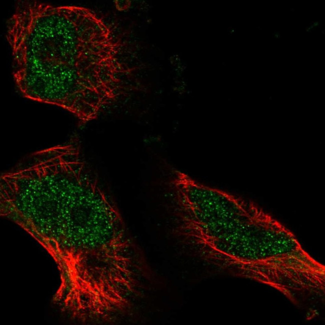ATE1 Antibody in Immunocytochemistry (ICC/IF)