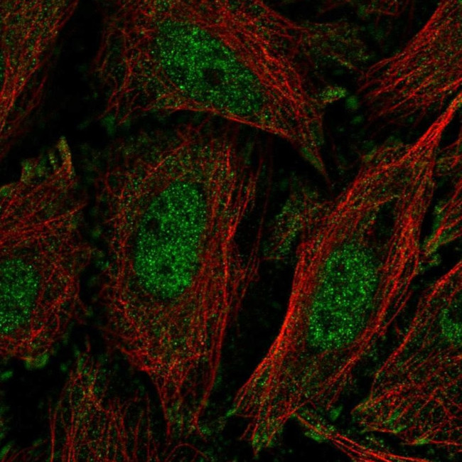 KLF11 Antibody in Immunocytochemistry (ICC/IF)